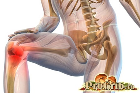 Боли в суставах